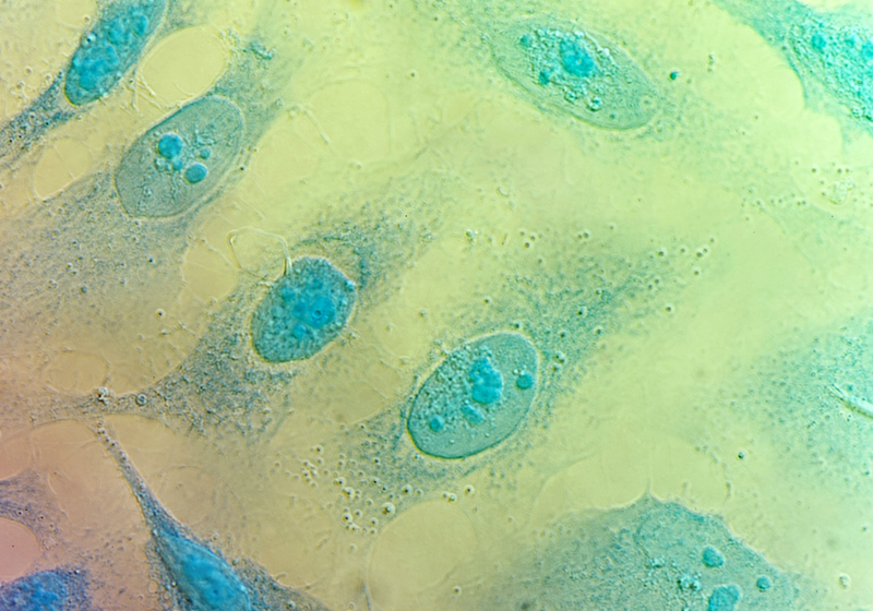 Daily Prompt: There is no Cure for&nbsp;Cancer